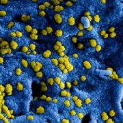 nieuw_coronavirus_in_chinaRS